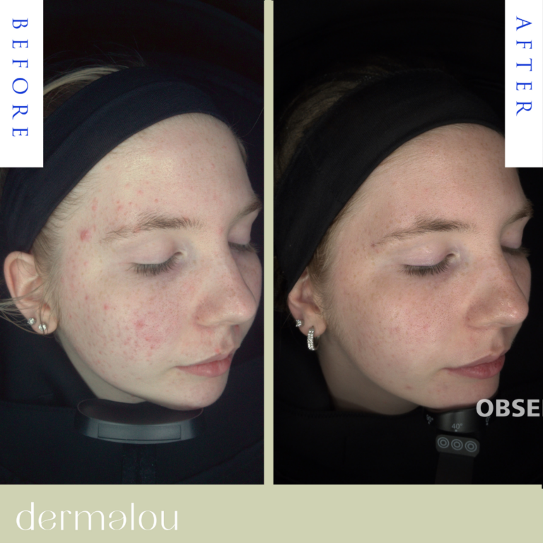 Template before after (2)